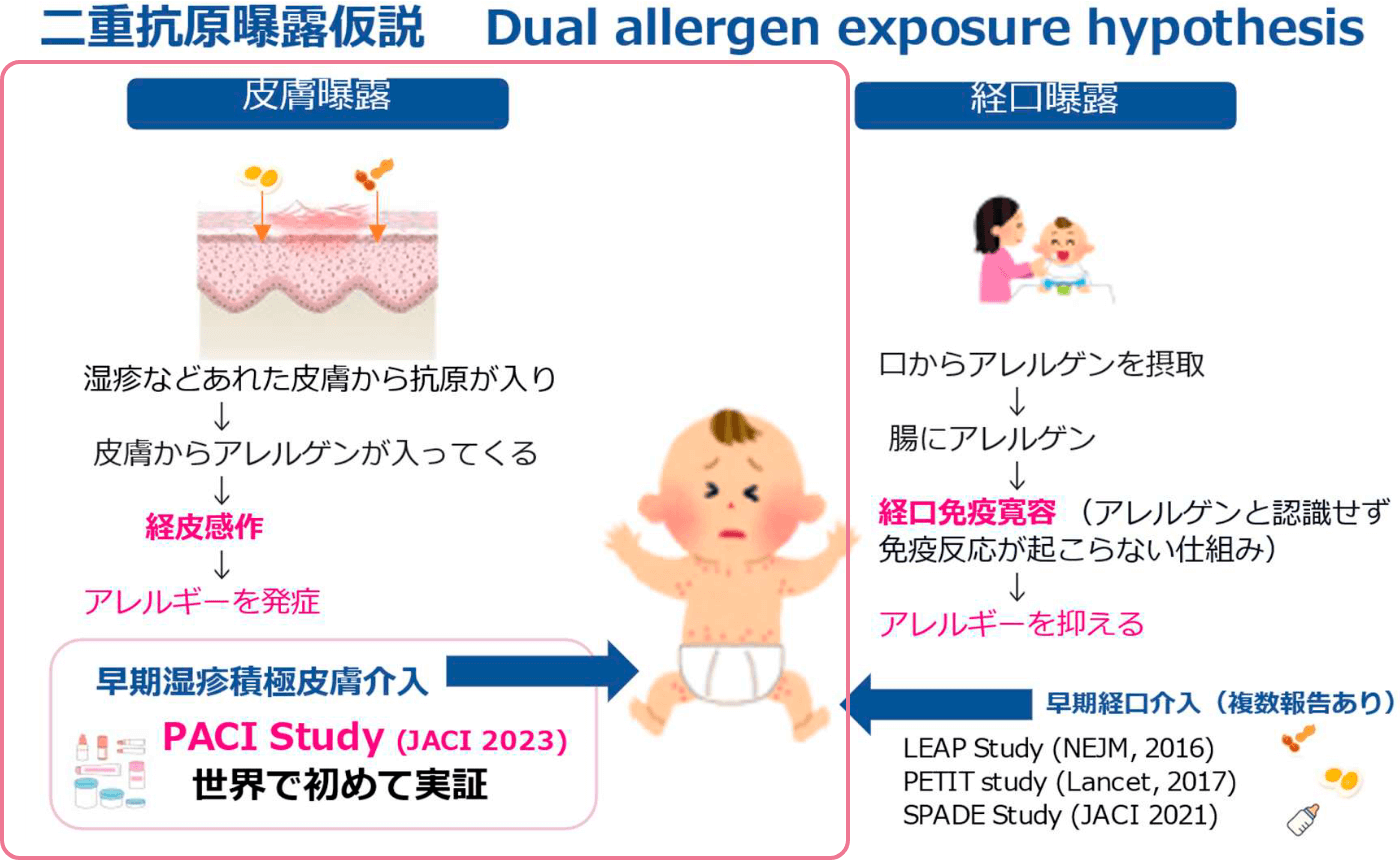 二重抗原曝露仮説 画像
