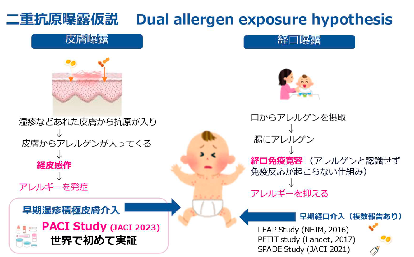 二重抗原曝露仮説 画像